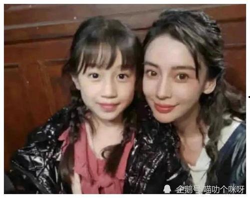 娱乐圈吃瓜爆料整容